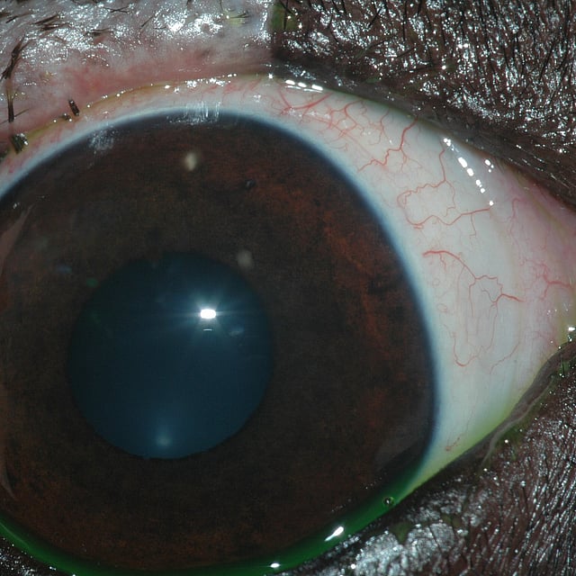 Un primer plano de un ojo.