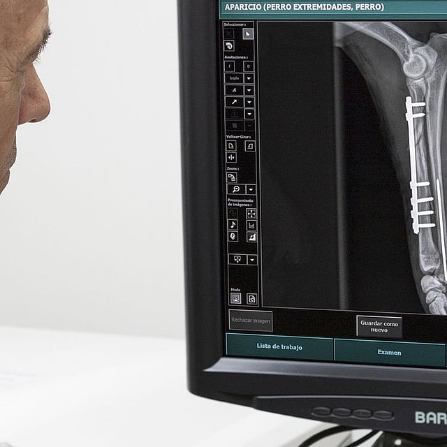 Una radiografía de una pierna.