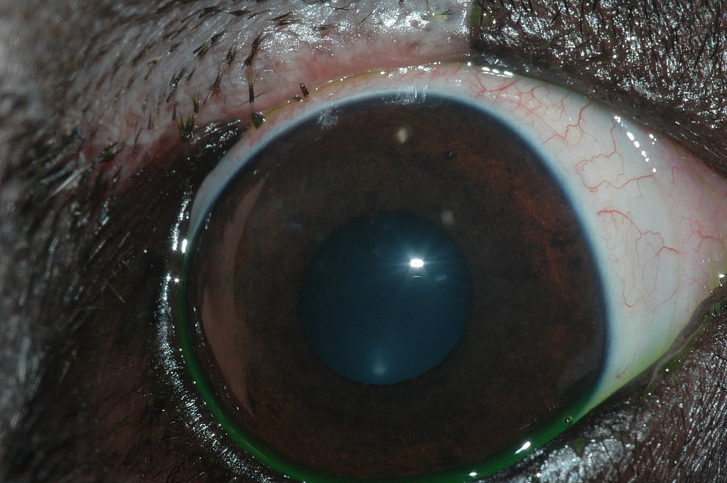 Un primer plano de un ojo.