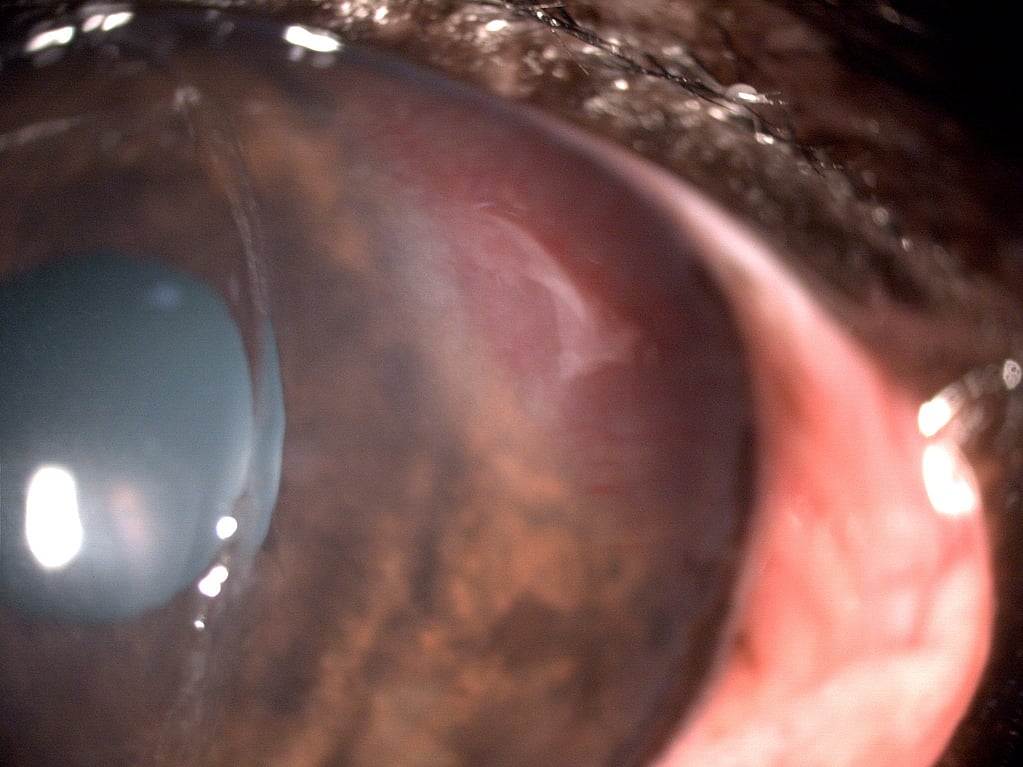 Un primer plano de un ojo.
