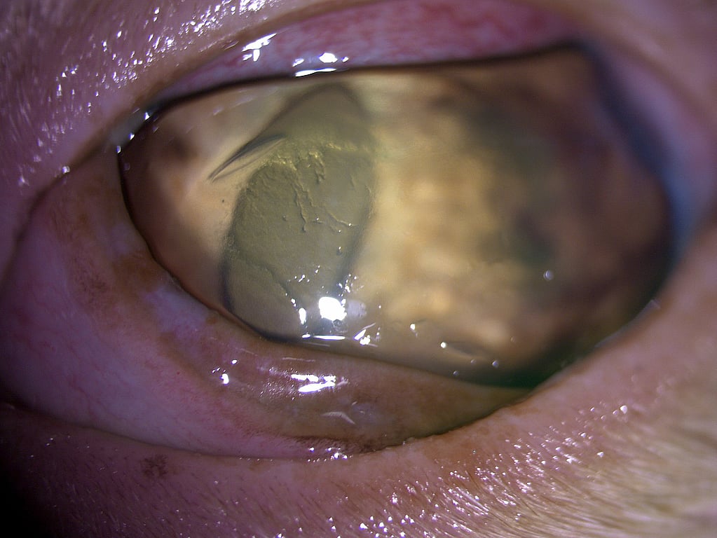 Un primer plano de un ojo.
