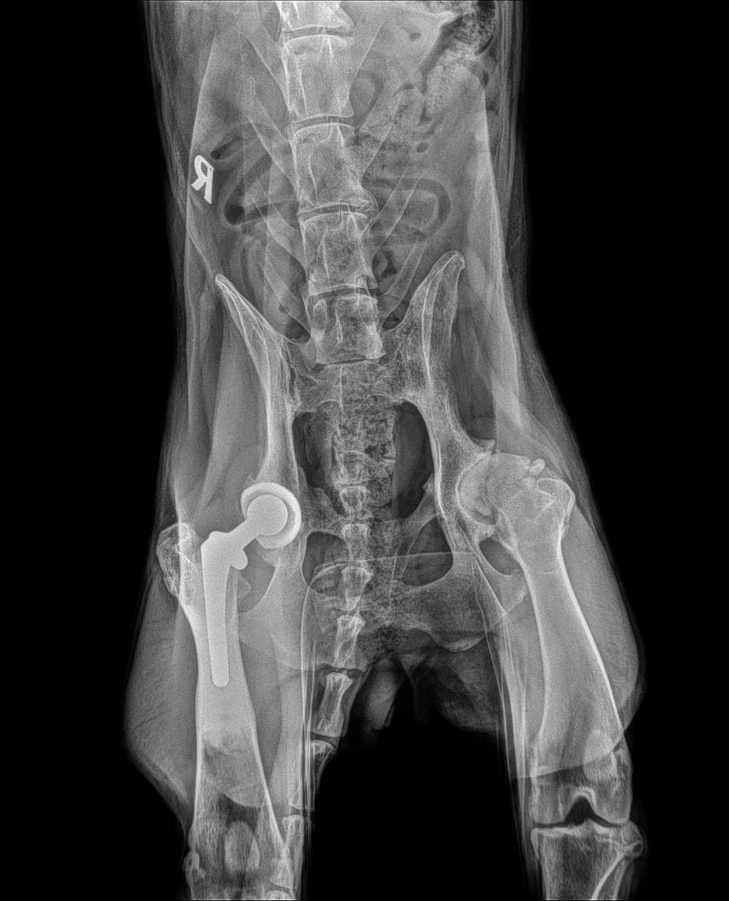 Radiografía del cuerpo de una persona.