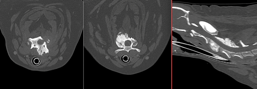 Un primer plano de una radiografía del cuerpo de una persona.